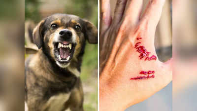 Dog bite treatment: कुत्ते के काटने पर 10 मिनट के भीतर करें ये 7 काम, वरना बढ़ सकता है जानलेवा रेबीज का खतरा