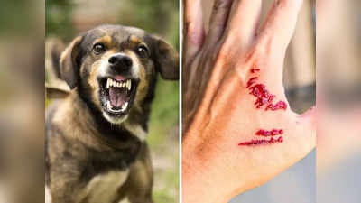 Dog Bite Treatment: कुत्रा चावल्यावर 10 मिनिटांच्या आत करा ही 7 काम, नाहीतर वाढू शकतो जीवघेण्या रेबीजचा धोका