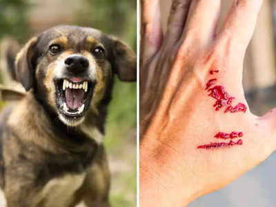 Dog Bite Treatment: कुत्रा चावल्यावर 10 मिनिटांच्या आत करा ही 7 काम, नाहीतर वाढू शकतो जीवघेण्या रेबीजचा धोका