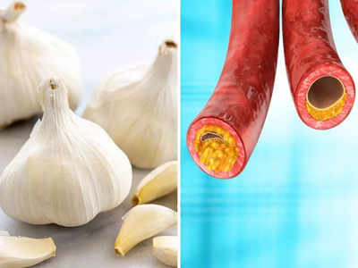 Raw garlic benefits: बासी मुंह लहसुन की 2 कली चबाकर पानी पिएं, दूर रहेंगी कोलेस्ट्रॉल-डायबिटीज जैसी 6 बीमारियां