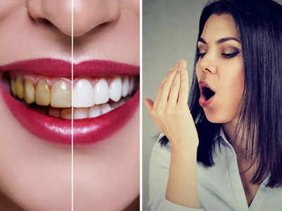Home remedies for bad breath: मुंह की बदबू को सिर्फ 5 मिनट में खत्म कर देंगी ये 6 चीजें, दांत भी होंगे सफेद