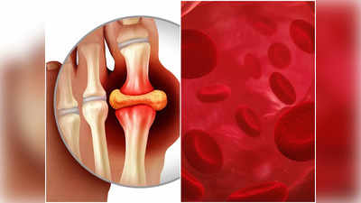 Uric Acid Affects Joints: বেছে বেছে এই জয়েন্টগুলিতে আক্রমণ চালায় Gout, যন্ত্রণা করলেই সতর্ক হতে বললেন চিকিৎসক