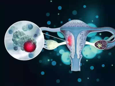 female cancer : பெண்களோட லைஃப்ஸ்டைல் இப்படி இருந்தா புற்றுநோய் அபாயத்தை குறைச்சிடலாமாம்… இனி ஃபாலோ பண்ணுங்க!