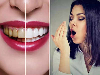 Home Remedies for Bad Breath: तोंडाच्या दुर्गंधीला अवघ्या 5 मिनिटांत दूर करतील 6 पदार्थ, दात देखील होतील सफेद