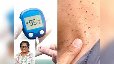 diabetes skin problems : உங்க சருமத்தில் இந்த 11 அறிகுறிகள்ல ஒண்ணு இருந்தாலும் இரத்த சர்க்கரை அதிகம்னு அர்த்தமாம்!