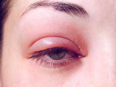 महिला की आंख-नाक से निकले 145 कीड़े, डॉक्टरों ने बताई चौंकाने वाली वजह, इन लोगों को है ज्यादा खतरा
