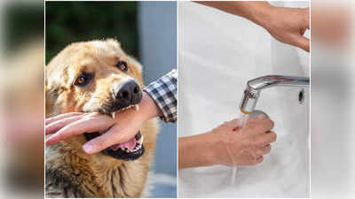Dog Bite Treatment: কুকুর কামড়ানোর পর এই ৫ কৌশল না মানলে Rabies প্রাণ কাড়ে, সতর্ক করলেন চিকিৎসক