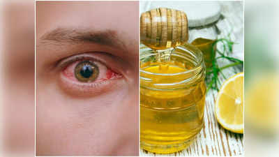 Foods for Eyesight: চোখ জ্বালা, চুলকানি, জল গড়ানোর মতো সমস্যা উবে যাবে, বিশেষজ্ঞের পরামর্শে এই ৬ খাবার খান