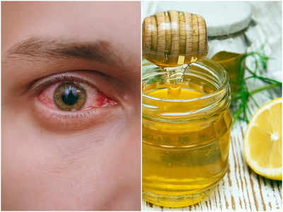 Foods for Eyesight: চোখ জ্বালা, চুলকানি, জল গড়ানোর মতো সমস্যা উবে যাবে, বিশেষজ্ঞের পরামর্শে এই ৬ খাবার খান