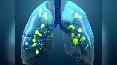 Food for lungs: फेफड़ों में भरे कचरे-कफ को बाहर निकाल फेंके ये 5 सुपरफूड, Lung cancer का जोखिम भी करेंगे कम