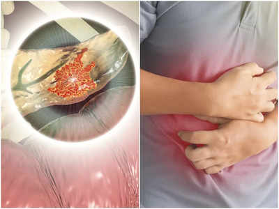 Pancreatitis Symptoms: পেটে ব্যথা, বমি অবহেলা নয়, হতে পারে প্রাণঘাতী প্যাংক্রিয়াটাইটিস! লক্ষণ জানালেন ডাক্তার