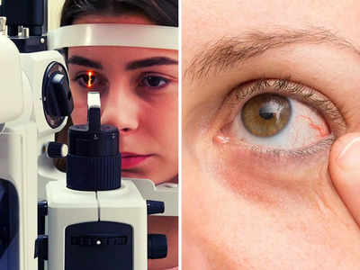 ये 4 लक्षण हैं Retina में खराबी के संकेत, तुरंत कराएं जांच वरना हमेशा के लिए छिन जाएगी आंखों की रोशनी