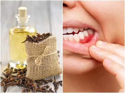 Clove Oil Benefits: শুধু লবঙ্গ নয়, এর তেলেও রয়েছে বহু গুণ, খেলেই দূর হবে ৪ সমস্যা