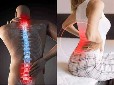 spinal injury : முதுகுத்தண்டுவட வலி தீவிரமாகாம தடுக்க தினசரி வாழ்க்கை முறையில் இதை ஃபாலோ பண்ணுங்க!