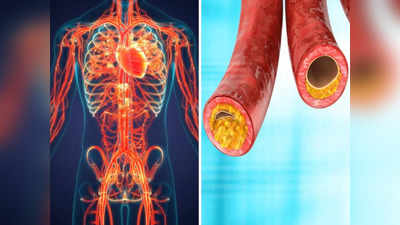 Coronary Artery Disease: एक ऐसी बीमारी जिसमें सिकुड़ जाती हैं खून की नसें, कभी भी आ सकता है हार्ट अटैक