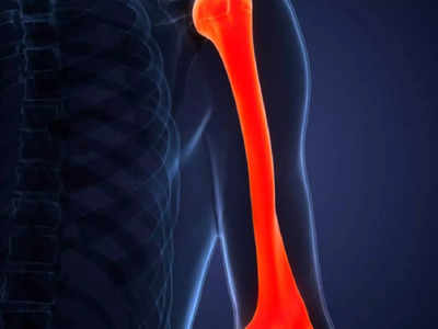 Bone Health: എല്ലുകളുടെ ആരോഗ്യം നിലനിര്‍ത്താന്‍ മുപ്പതുകളില്‍ നിങ്ങള്‍ ഒഴിവാക്കേണ്ട ചില കാര്യങ്ങള്‍