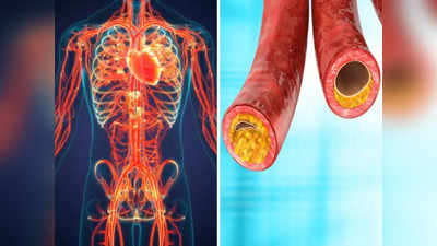 Coronary Artery Disease : या आजारामुळे रक्ताच्या नसा आकसतात, हृदयविकाराची भीती, अशावेळी घरगुती उपाय फायदेशीर