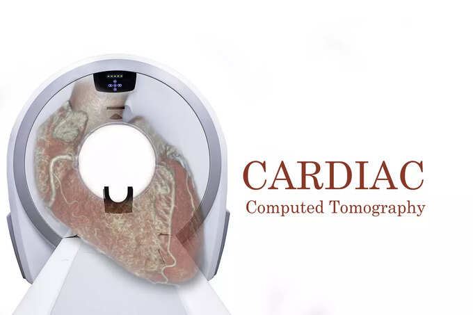 ​కరోనరీ కంప్యూటెడ్ టోమోగ్రఫీ యాంజీయోగ్రామ్ Coronary computed tomography angiogram (CCTA)