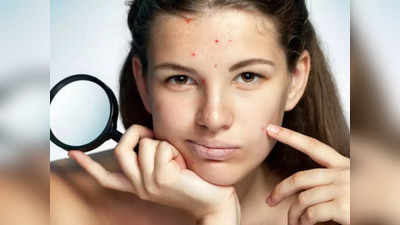 acne problem : பீரியட்ஸ் வந்தாலே பருவும் கூட சேர்ந்து வருதா... ரெண்டு நாள் முன்னாடியே இத அப்ளை பண்ணுங்க... வராது...