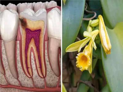 Tooth Pain Remedies : दातांतील जीवघेण्या वेदना, सडलेल्या दाढदुखीपासून 10 मिनिटांत मुक्ती देतात हे 6 घरगुती उपाय