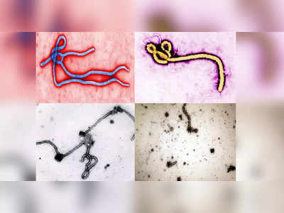 ये वायरस बनेगा अगली महामारी! इबोला की तरह हैं लक्षण, नए शोध से वैज्ञानिकों ने दुनिया को किया सतर्क