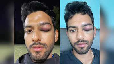 Unmukt Chand Injury: उनमुक्त चंद की आंख पर लगी गंभीर चोट, बाल-बाल बचा भारत का यह पूर्व क्रिकेटर