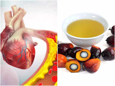 Worst Oil for Cholesterol: সব তেল নয়, এই ৫ ফ্যাট কোলেস্টেরল বাড়িয়ে রক্তনালীর ভিতরে জমে বলে জানালেন চিকিৎসক