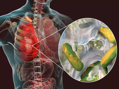 Water in lungs: अगर दिखे ये 15 लक्षण तो समझ लें फेफड़ों में भर गया पानी, सुखाने के लिए आजमाएं ये 6 घरेलू उपचार