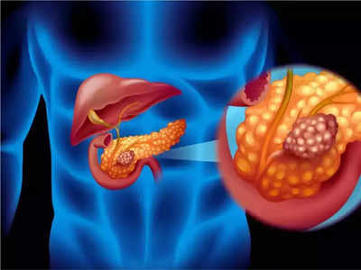 या अवयवात वेदना म्हणजे शरीरात पसरला भला मोठा ट्यूमर, ही 7 लक्षणे सांगतात तुम्हाला झाला Pancreatic Cancer कॅन्सर