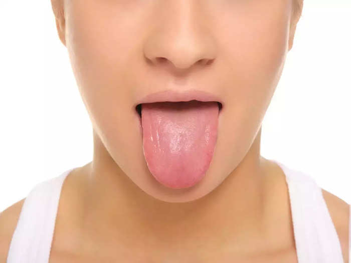 dry mouth problem in pregnancy