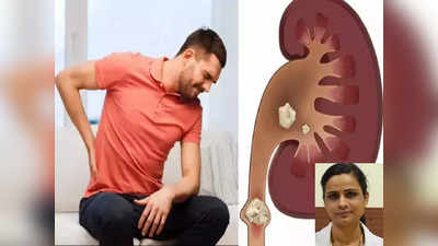 kidney stone: இந்த உணவுகள் கிட்னி ஸ்டோனை உண்டாக்கலாம். எச்சரிக்கும் நிபுணர்!