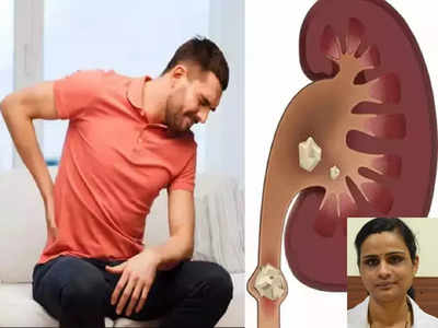 kidney stone: இந்த உணவுகள் கிட்னி ஸ்டோனை உண்டாக்கலாம். எச்சரிக்கும் நிபுணர்!