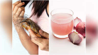Onion Oil For Hair: পেঁয়াজের তেল মাখলে ১ সপ্তাহেই বন্ধ হয় চুল পড়া! জেনে নিন বাড়িতে কীভাবে বানাবেন, খরচ মাত্র ৩০ টাকা