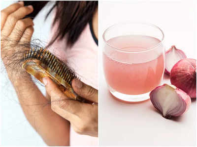 Onion Oil For Hair: পেঁয়াজের তেল মাখলে ১ সপ্তাহেই বন্ধ হয় চুল পড়া! জেনে নিন বাড়িতে কীভাবে বানাবেন, খরচ মাত্র ৩০ টাকা
