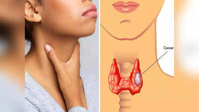तिशीतल्या मुलींमध्ये वाढतोय जीवघेणा Thyroid Cancer, थकवा-गळ्याचं दुखणं यासारख्या 8 लक्षणांकडे करू नका दुर्लक्ष