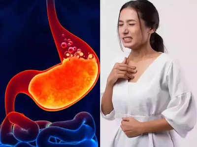 heartburn remedy : நெஞ்செரிச்சல் இருக்கும் போது வாழைப்பழம் சாப்பிடுங்க.. வேற என்ன செய்தா சரி ஆகும்!