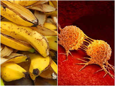 Benefits of Eating Banana Peels: প্রাণঘাতী ক্যানসার থেকে বাঁচায় কলার খোসা, খাওয়ার পরামর্শ দিলেন পুষ্টিবিদ