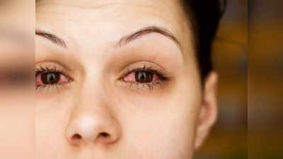 हा आजार काढतो डोळ्यातून रक्त, हलक्यात घेऊ नका, तुमचे डोळे चोळणे याला कारणीभूत, काय म्हणतात Eye Specialist