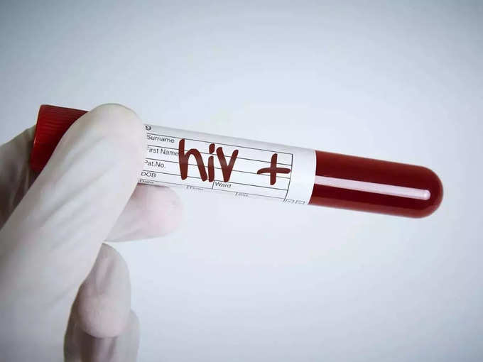 ​HIV