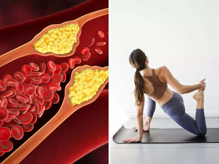 bad ldl cholesterol is harmful for heart and overall health must do these 5 things to reverse this condition