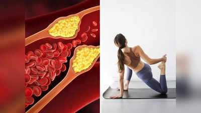 Can you reverse high cholesterol: खून की नली में भरा Bad LDL कोलेस्ट्रॉल हो जाएगा जड़ से साफ, बस करें ये 5 काम
