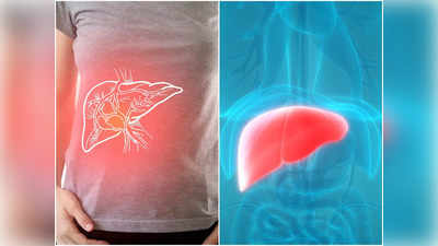 Fatty Liver Symptoms: পেটের কোথায়, কেমন ব্যথা হলে বুঝবেন নিশ্চিত ফ্যাটি লিভার হয়েছে, উত্তরে চিকিৎসক