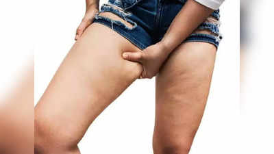 Thigh Fat:തുട വണ്ണമാണോ നിങ്ങളുടെ പ്രശ്‌നം? അത് കുറയ്ക്കാന്‍ ഇതാ ചില എളുപ്പ മാര്‍ഗങ്ങള്‍
