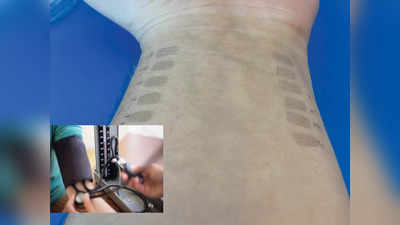 Blood Pressure Tattoo: ના મશિન, ના મોનિટરિંગની ઝંઝટ, વૈજ્ઞાનિકોએ બ્લડ પ્રેશર માપવાનું ટેટૂ શોધ્યું