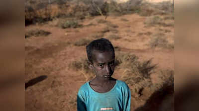जब सोशल मीडिया पर ट्रेंड हो रहा था वर्ल्‍ड फूड डे, तब सोमालिया में भूख से दम तोड़ रहा था दो साल का बच्‍चा
