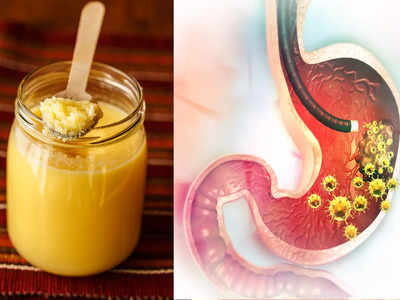 Ayurveda Bloating Remedy: পেট ফেঁপেছে বা গুড়গুড় আওয়াজ করছে? আয়ুর্বেদ ডাক্তারের এই রেসিপি নিমিষেই পরিষ্কার করে দেবে