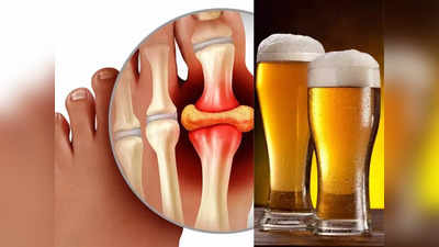 बिअरसोबत चखण्याला नॉनवेज खाताय? लवकर सोडा ही सवय, रक्तात झपाट्याने वाढतो Uric Acid, किडनीमध्ये होईल स्टोन