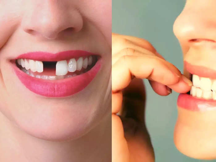 6 bad habits you should quit right now to save you teeth according to dentist