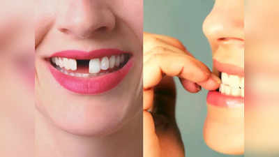 Bad oral habits: डेंटिस्ट ने बताए इन 6 आदतों में कर लें सुधार नहीं तो बुढ़ापे से पहले ही गिर जाएंगे सारे दांत