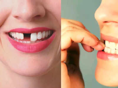 Bad oral habits: डेंटिस्ट ने बताए इन 6 आदतों में कर लें सुधार नहीं तो बुढ़ापे से पहले ही गिर जाएंगे सारे दांत